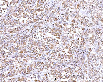 Anti-RPN1 Antibody