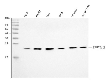 RNF212 Antibody
