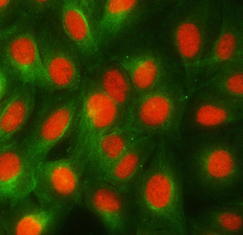 Anti-RBMY1A1 Antibody