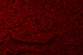 Anti-RNF40 Antibody