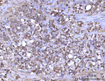 Anti-RFX1 Antibody