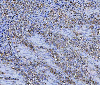 Anti-Asparagine synthetase/ASNS Antibody