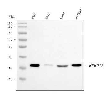P15RS/RPRD1A Antibody