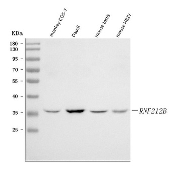 RNF212B Antibody