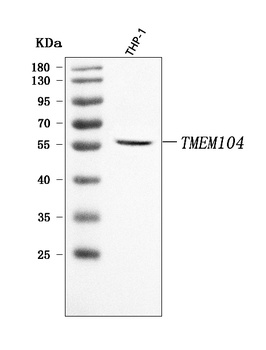TMEM104 Antibody