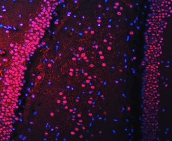 Anti-RBM22 Antibody