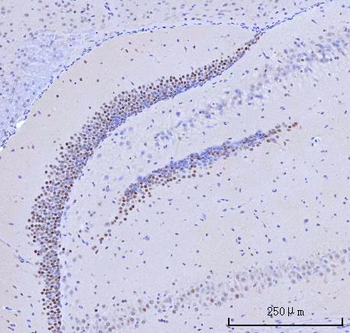 Anti-RFX3 Antibody