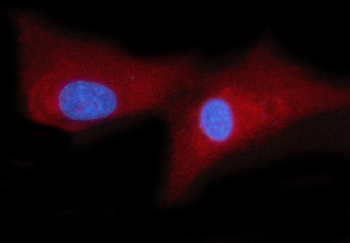 Anti-WRS/WARS1 Antibody