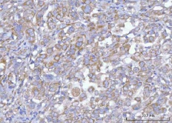 Hamartin/TSC1 Antibody
