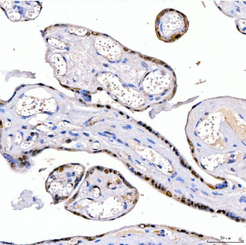 Anti-LIN28B Antibody