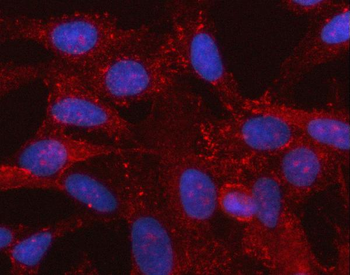 Anti-SPOCK3 Antibody