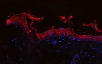 Anti-Cytokeratin 1/Krt1 Antibody