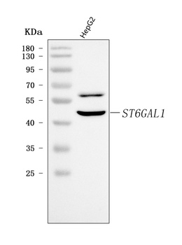 CDw75/ST6GAL1 Antibody