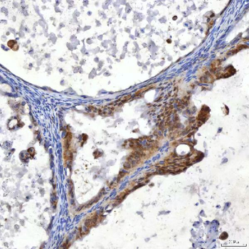 Anti-SUMF2 Antibody