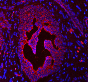 Anti-Cytokeratin 4/KRT4 Antibody