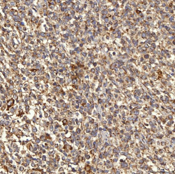 Anti-RAB7/RAB7A Antibody