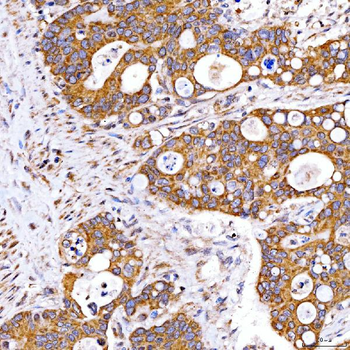 Anti-Rab4/RAB4A Antibody