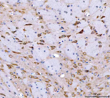 Anti-SRGAP3 Antibody