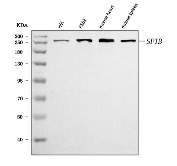 beta 1 Spectrin/SPTB Antibody