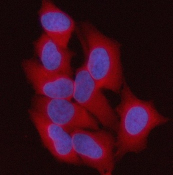 ST13 Antibody