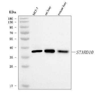 PCTP-L/STARD10 Antibody