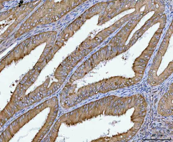 Anti-SPATA18 Antibody
