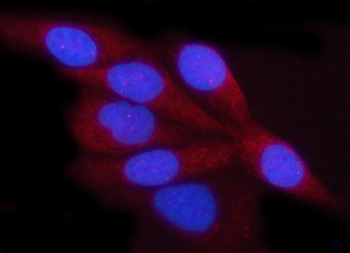 Anti-Porin/VDAC1 Antibody