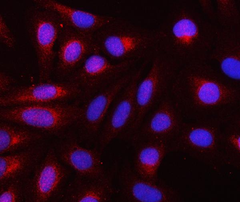Anti-REEP3 Antibody