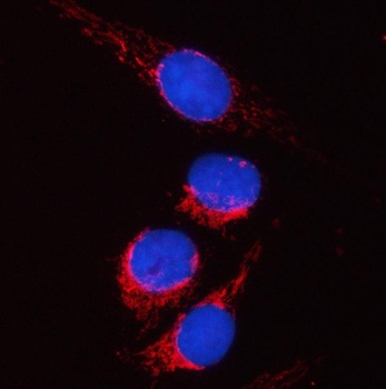 PYCR2 Antibody