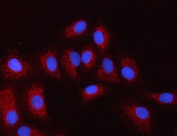 Anti-PXK Antibody