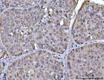Anti-PSMD4 Antibody