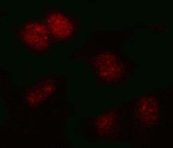 Anti-PSMB2 Antibody