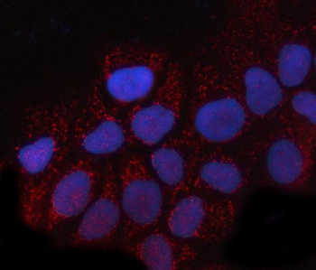 Anti-PRTFDC1 Antibody