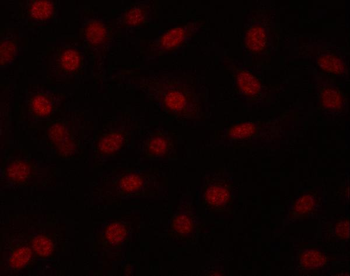 Anti-PRPF19 Antibody