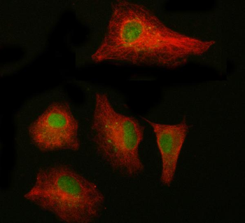 Anti-NAB1 Antibody