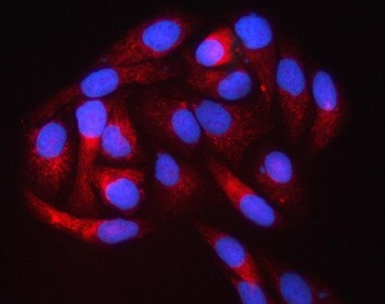 Anti-PIGS Antibody