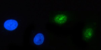 Anti-POLR3GL Antibody