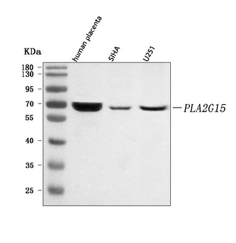LYPLA3/PLA2G15 Antibody