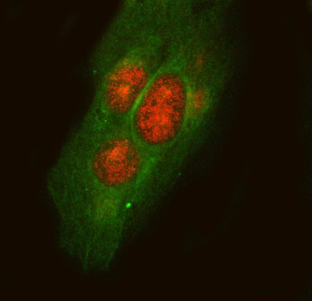 Anti-LYPLA3/PLA2G15 Antibody