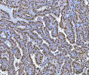 Anti-BCL11B Antibody