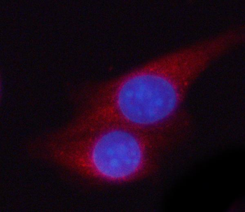 Anti-PGK2 Antibody