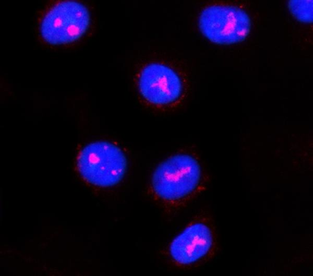 Anti-PPAN Antibody