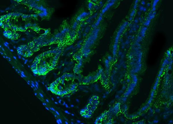 Anti-CD326/Epcam Antibody