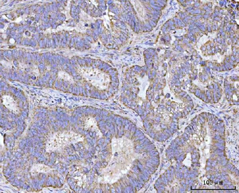 Anti-Renin/REN Antibody