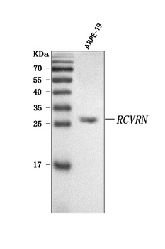 Recoverin/RCVRN Antibody