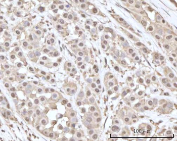 Anti-Recoverin/RCVRN Antibody