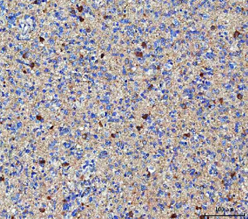 Anti-MGAT4B Antibody