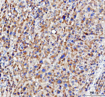 Anti-NUDT6 Antibody