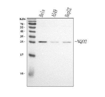 Anti-NQO2 Antibody