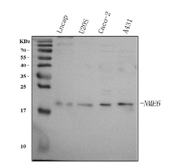 Anti-NME6 Antibody